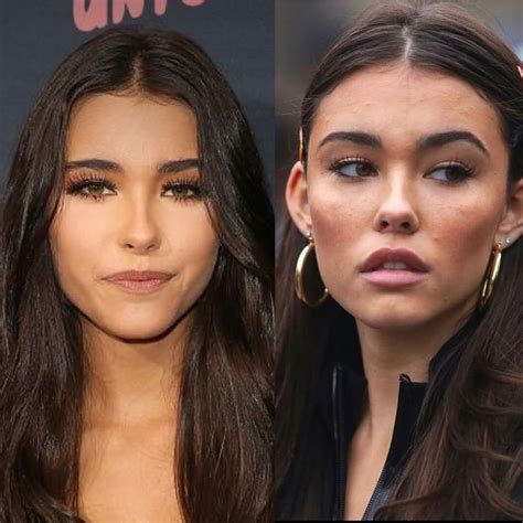 madison beer plastic surgery|The Truth About Madison Beers Plastic Surgery Rumors